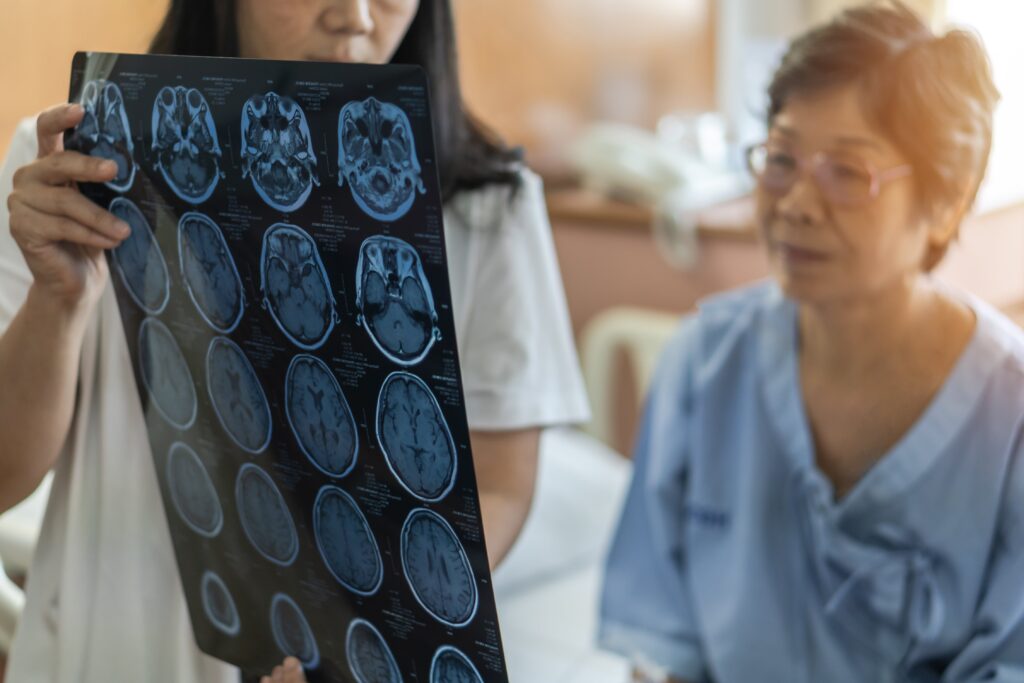 brain cancer awareness